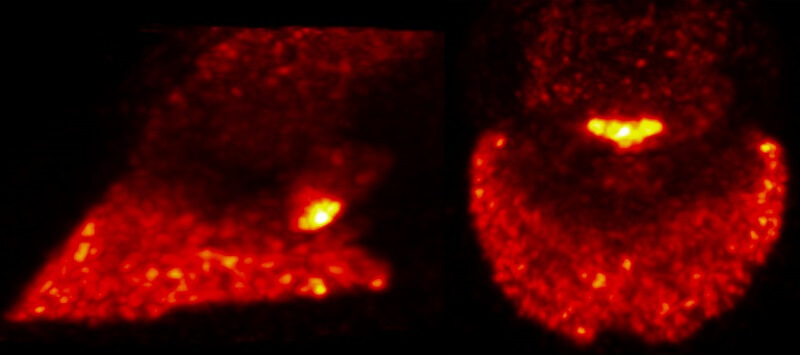 Positron Emission Tomography Performed on Standing Horse for First Time